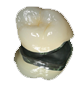 zirconia-Icon